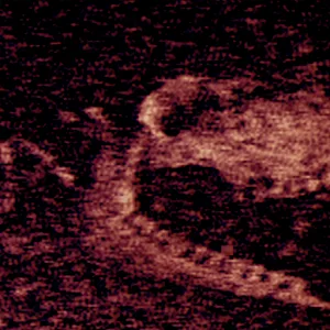 Iron Lung - vvAndroid